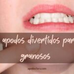 28 apodos creativos y divertidos para un adolescente con acne